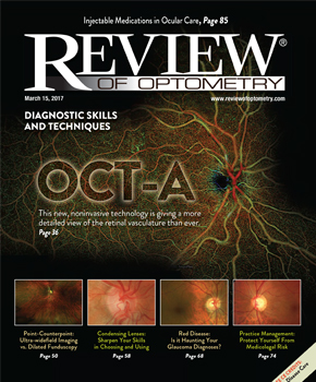 Review of Optometry