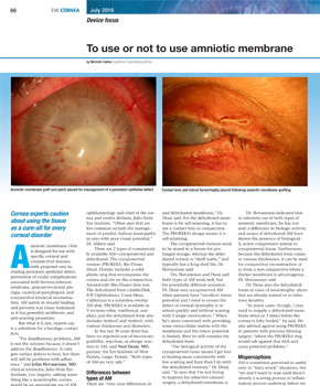 To use or not use Amniotic membrane